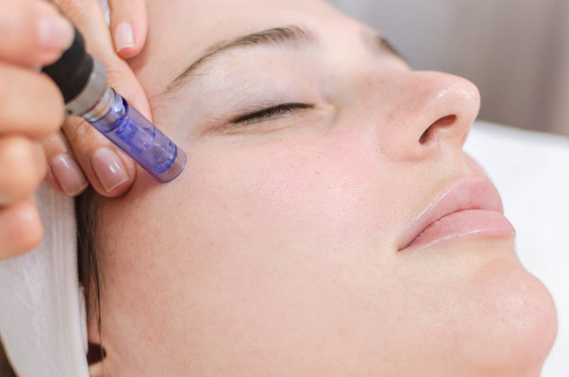 how long has microneedling been around