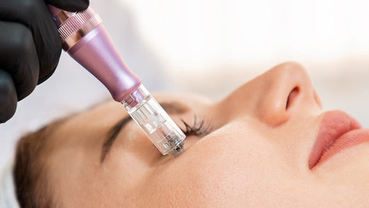 when can you exfoliate after microneedling