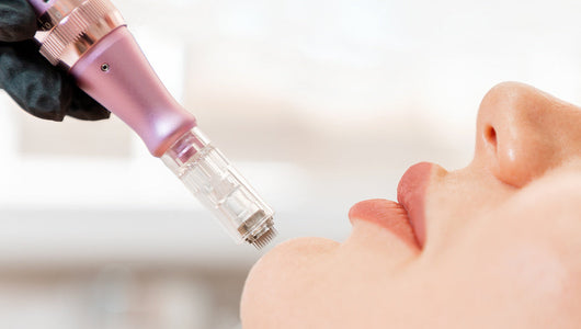 what is microneedling used for