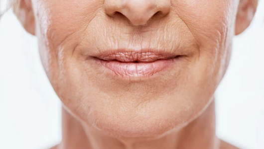 microneedling for wrinkles