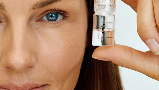 microneedling for blackheads
