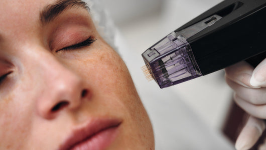 does microneedling cause bleeding