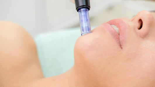 how long does microneedling last