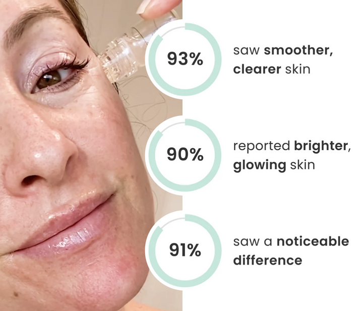 Micro-Infusion For Wrinkles (2 Refill Treatments)