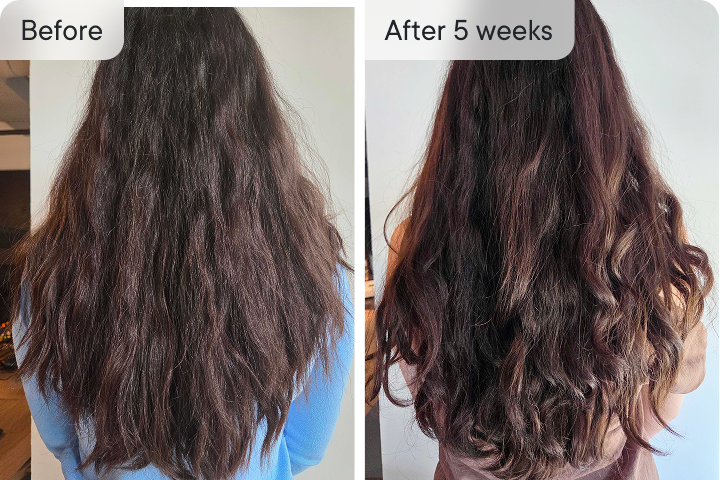 Hair growth before and after 5 weeks