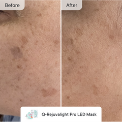 Fade & Firm Bundle Advanced