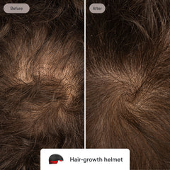 Hair Loss Prevention System