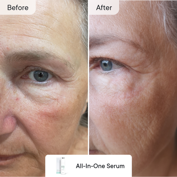 Line Refine Bundle Essential