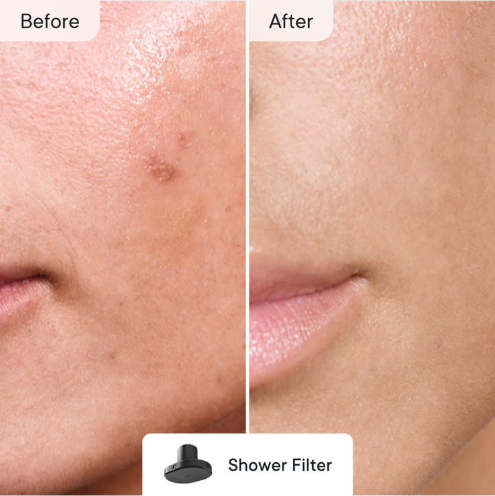 Breakout Control Pro