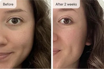 before and after 2 weeks.