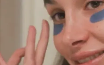 Woman with eye patches, part of aftercare routine.