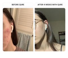 All-In-One Face Serum 6 Month Bundle