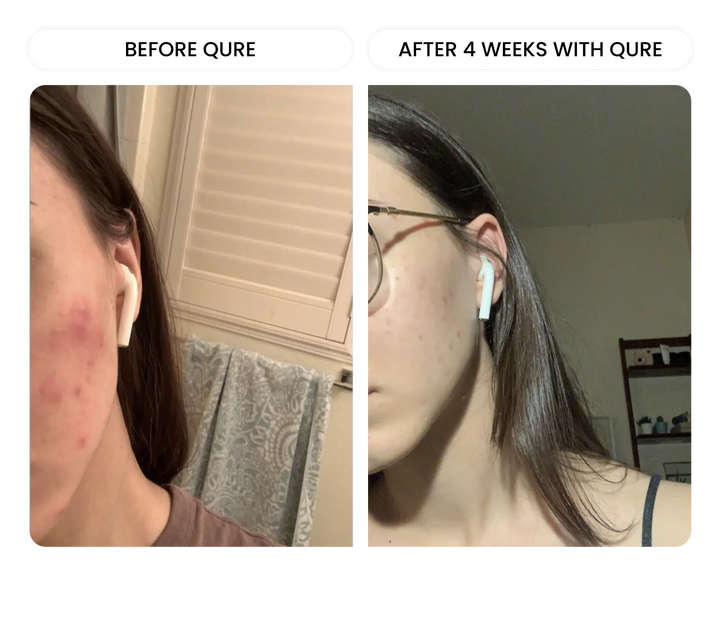 All-In-One Face Serum 6 Month Bundle