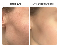 All-In-One Face Serum 6 Month Bundle