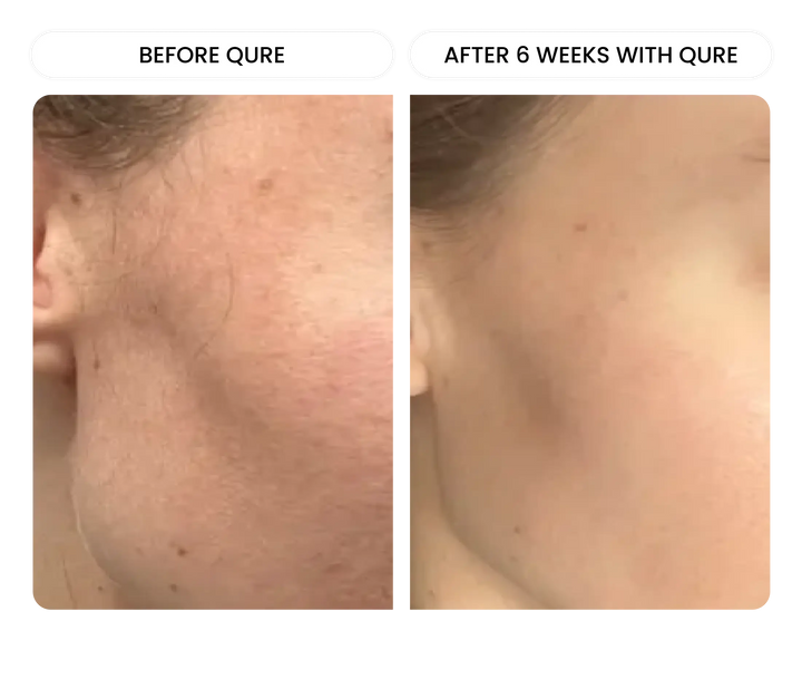 All-In-One Face Serum 6 Month Bundle
