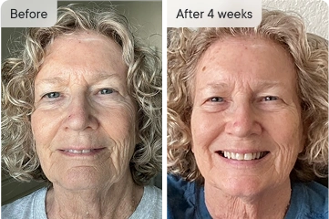 Cheryl's before & after 4-week results