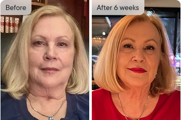 Dorothy's before and after transformation after 6 weeks.