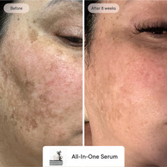 Skin Confidence System