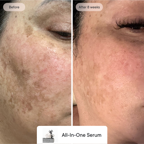 Skin Confidence System