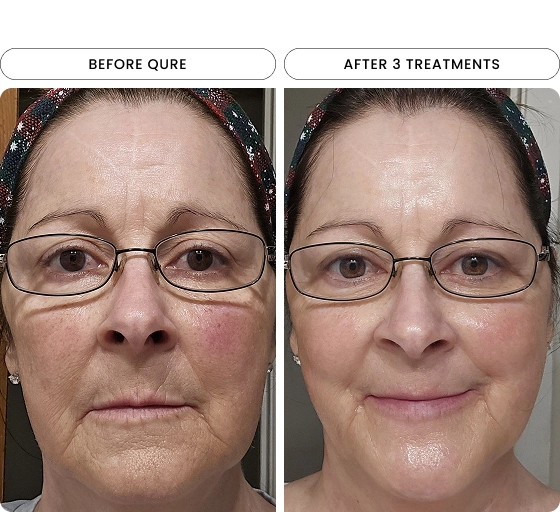 dark spots reduced