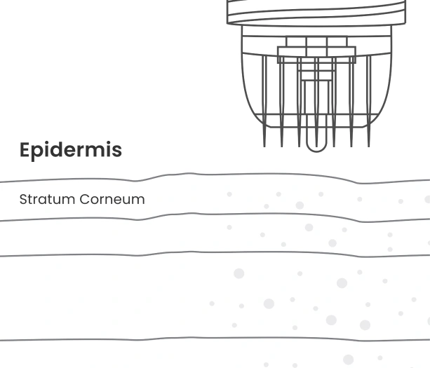 Mi needle penetrating epidermis layers