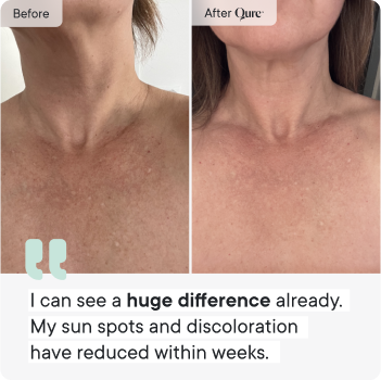 Neck & Décolletage System