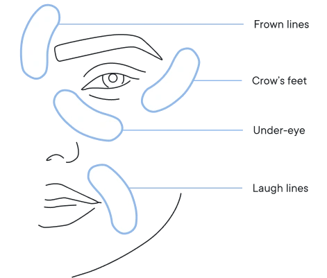 tg-frame diagram with labels